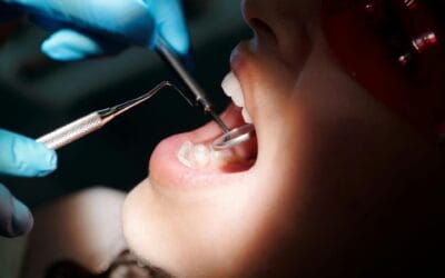 Understanding Oral Cancer: Prevention, Symptoms, and the Role of Dental Care